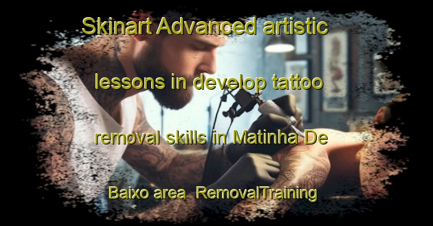 Skinart Advanced artistic lessons in develop tattoo removal skills in Matinha De Baixo area | RemovalTraining | RemovalClasses | SkinartTraining-Brazil