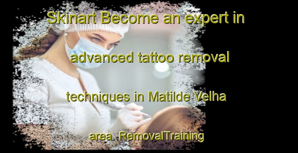Skinart Become an expert in advanced tattoo removal techniques in Matilde Velha area | RemovalTraining | RemovalClasses | SkinartTraining-Brazil