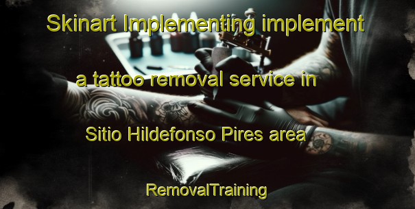 Skinart Implementing implement a tattoo removal service in Sitio Hildefonso Pires area | RemovalTraining | RemovalClasses | SkinartTraining-Brazil