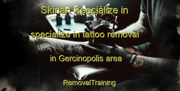 Skinart Specialize in specialize in tattoo removal in Gercinopolis area | RemovalTraining | RemovalClasses | SkinartTraining-Brazil