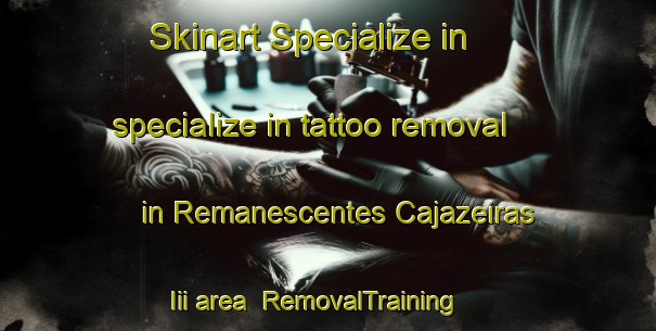 Skinart Specialize in specialize in tattoo removal in Remanescentes Cajazeiras Iii area | RemovalTraining | RemovalClasses | SkinartTraining-Brazil