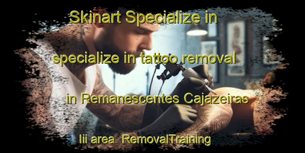 Skinart Specialize in specialize in tattoo removal in Remanescentes Cajazeiras Iii area | RemovalTraining | RemovalClasses | SkinartTraining-Brazil